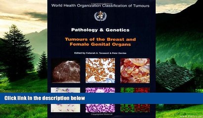 READ FREE FULL  Pathology and Genetics of Tumours of the Breast and Female Genital Organs (IARC