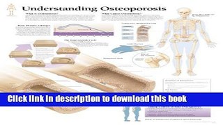 [Popular] Understanding Osteoporosis chart: Laminated Wall Chart Paperback Online