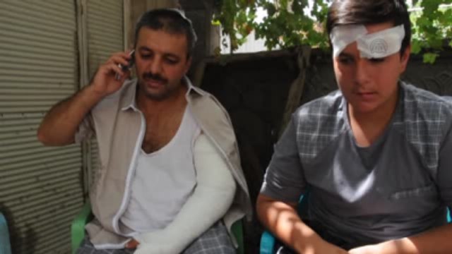 Hem Daeş Hem Fetö Hem de PKK'nın Terör Saldırısını Atlattı