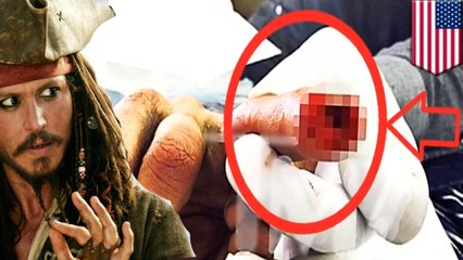 Johnny Depp cut off his fingertip during drunken argument, claims Amber Heard