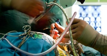 Kafatasından 12 Santimetre Çapında Tümör Çıkartıldı