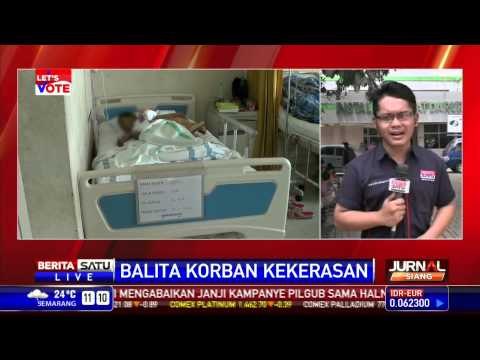 Kondisi Iqbal Masih Kritis