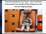This Video Will Break Your Heart – New Viral Photo of Wounded 5-Year-Old Boy
