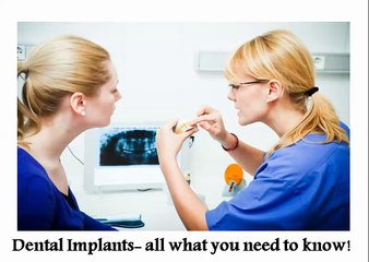 Dental implants-all what you need to know