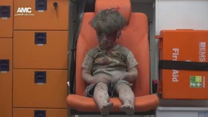 Suriye Halep'teki yaralı çocuğun bakışları dünyanın içine işledi!