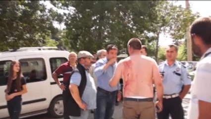 Trafik Kazası Sonrası Bıçaklı Kavga