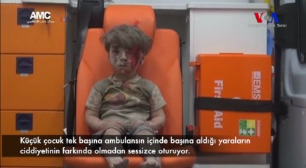 Enkazdan Çıkarılan Çocuk Halep’te Yaşananların Simgesi Oldu