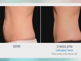 Precise Body wants you to be thankful for your new body this Thanksgiving