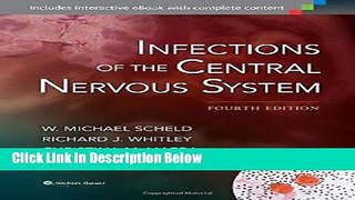 Books Infections of the Central Nervous System Free Download