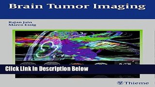 Ebook Brain Tumor Imaging Free Online