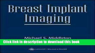 [Popular Books] Breast Implant Imaging Full Online
