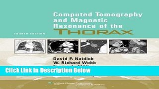Books Computed Tomography and Magnetic Resonance of the Thorax Full Online