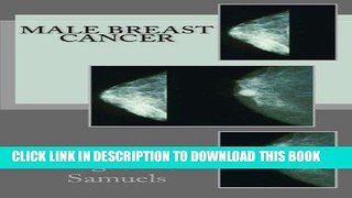 [PDF] Male Breast Cancer by Augustine Samuels MA (2011-11-30) Full Collection