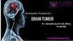 Brain Tumor Treatment in Bangalore - Best Holistic Cancer Treatment in India