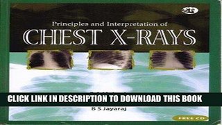 [FREE] EBOOK Principles and Interpretation of Chest X-rays BEST COLLECTION