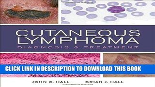 [READ] EBOOK Cutaneous Lymphoma: Diagnosis and Treatment BEST COLLECTION
