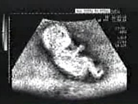 Ecco cosa già facevo nella pancia della m