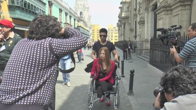 Peruana con cuádruple amputación por presunta negligencia médica pide ayuda al Gobierno