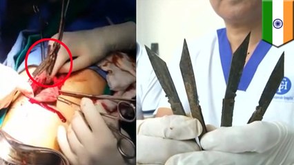 Doctors remove 40 knives from stomach of man with metal craving