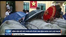 Bệnh viện Việt Đức phản hồi về hình ảnh bệnh nhân nằm che ô