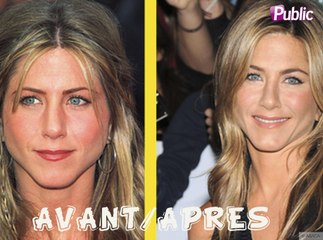 Avant/Après : 10 stars qui ont changé physiquement !