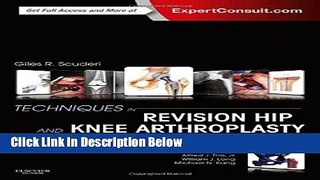 [Best Seller] Techniques in Revision Hip and Knee Arthroplasty, 1e New Reads