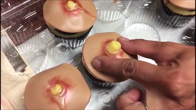 Des cupcakes en forme de boutons d'acné !