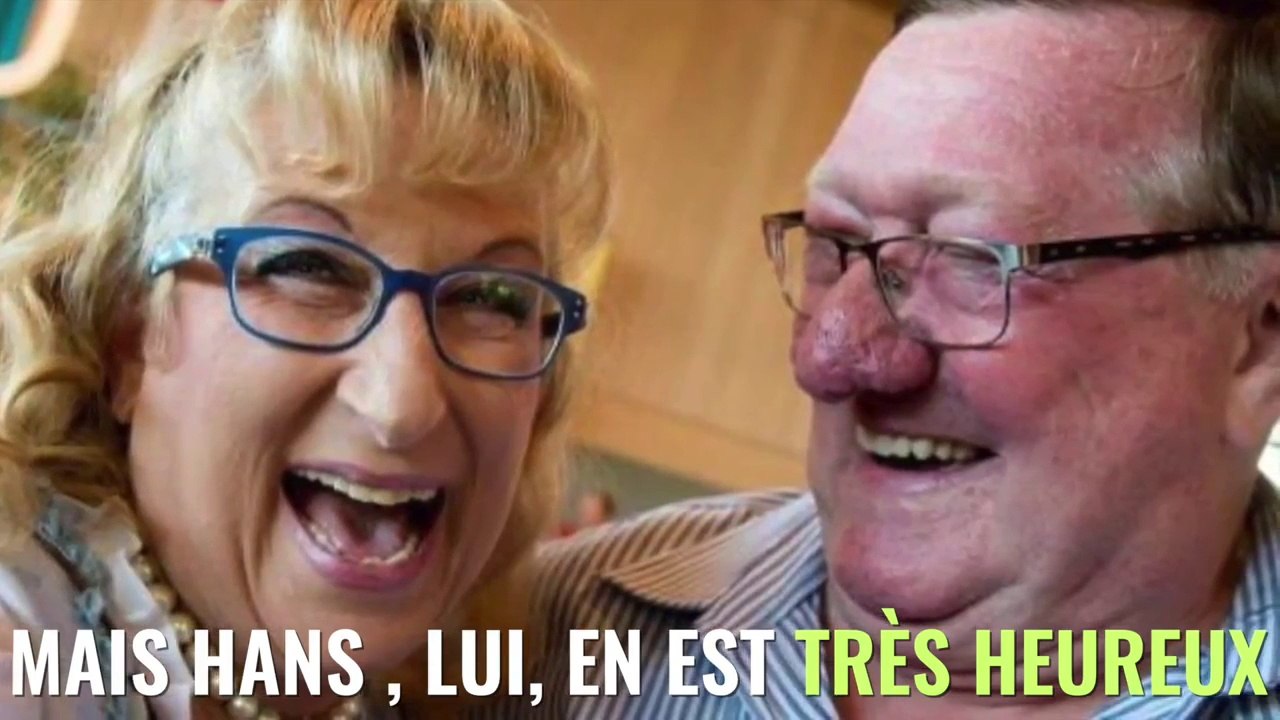 Championnat du monde du plus gros nez du monde Vidéo Dailymotion