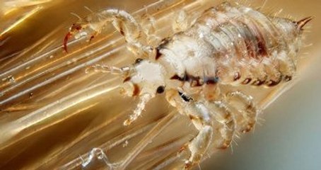 Dubai'de Saç Uzatmak İçin Bitlendirme Uygulaması Yapılıyor