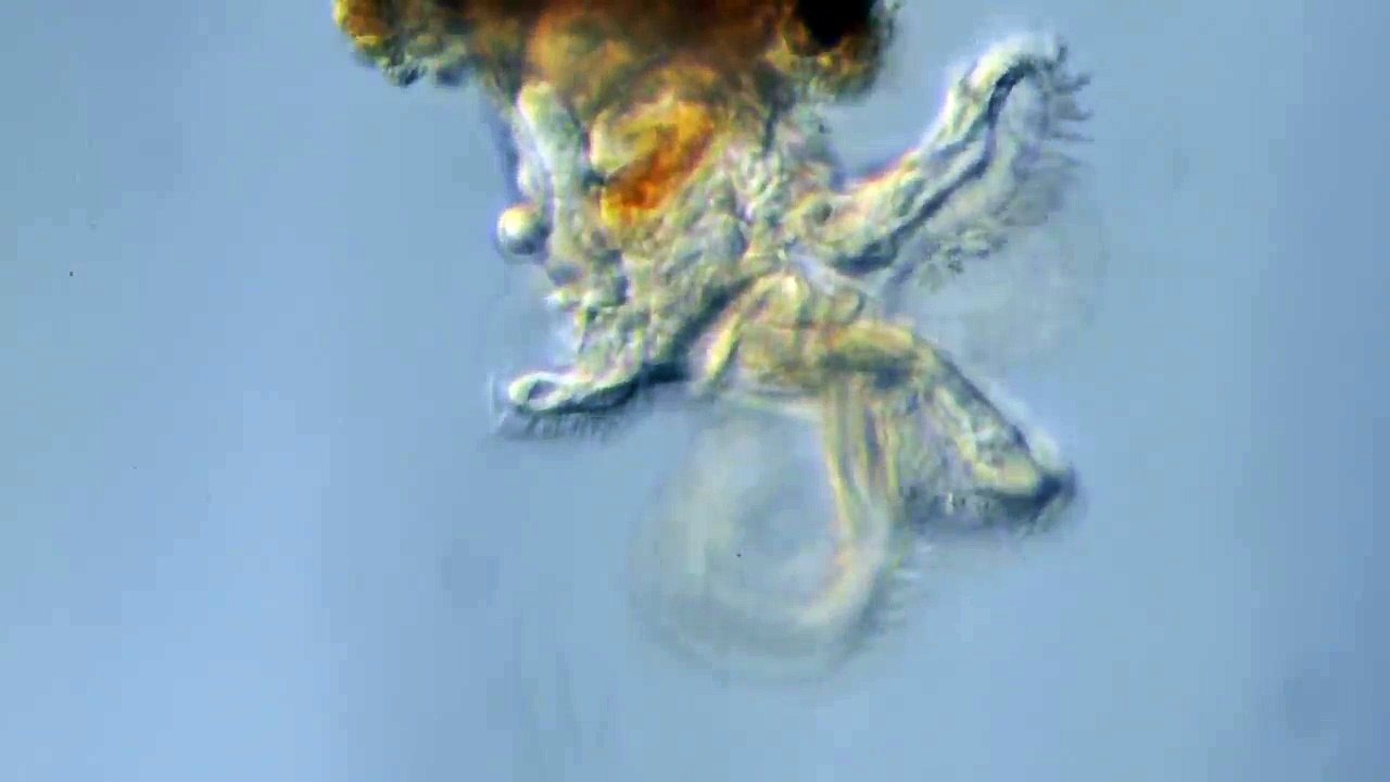 Rotifère-Melicerta-ringens