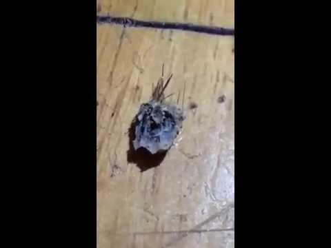 Girl Has Absolutely Massive Blackhead Removed From Bellybutton