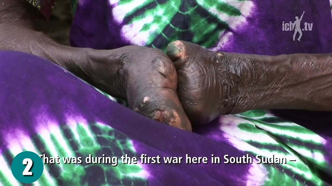 3 MUTATIONS INCROYABLES DU CORPS HUMAIN - Sais-tu que?