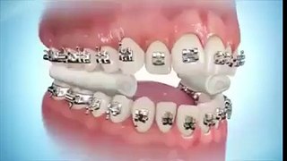 How teeth works