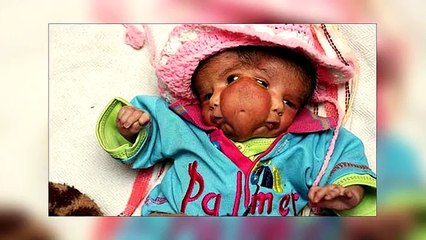 Gerçek Olduğuna İnanamayacağınız 7 Bebek