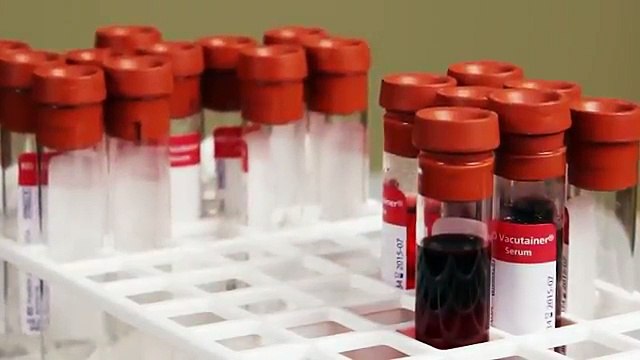 Adjustable Height Blood Drawing Chairs