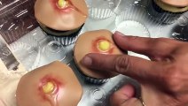 Des cupcakes en forme de boutons d'acné