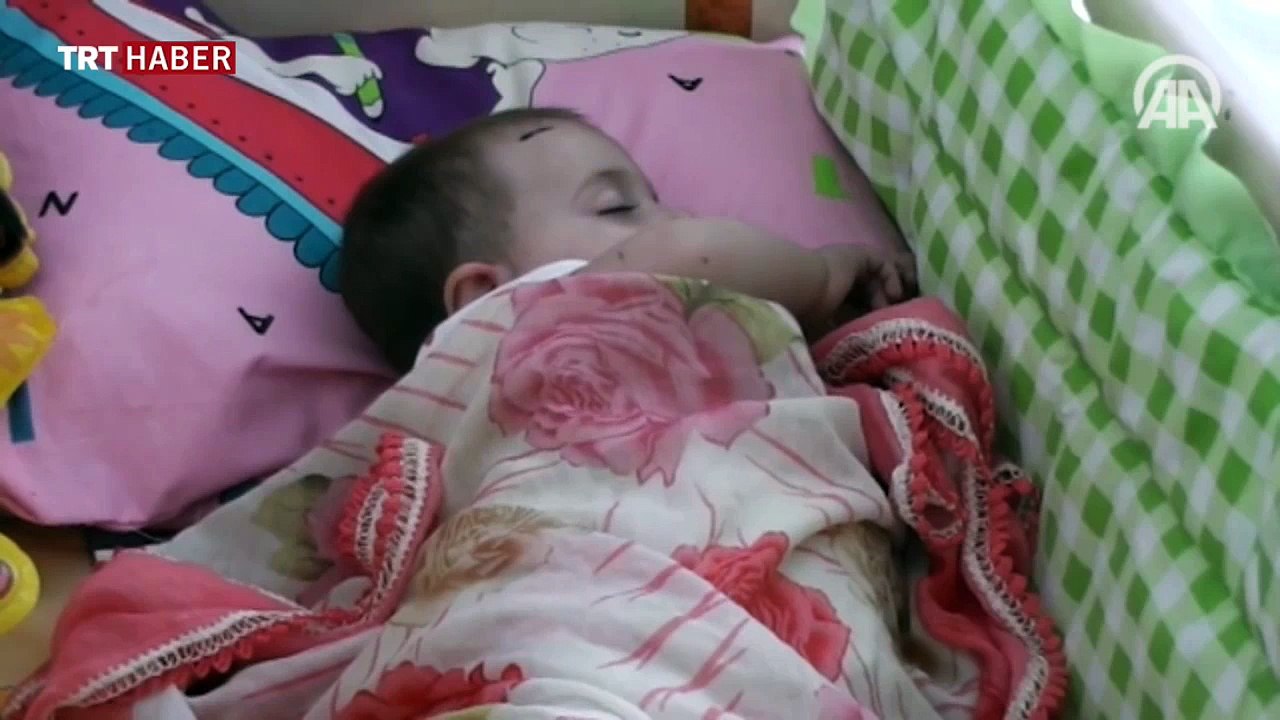 Esma bebek iyileşti kardeşleri yoğun bakımda