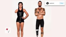 Vogue Brazil Under Fire for Photoshopping Models to Look Disabled