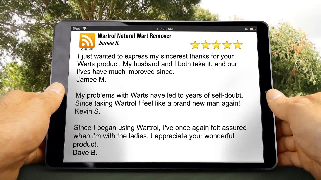 Where Can I Buy Wart Remover in Eugene OR