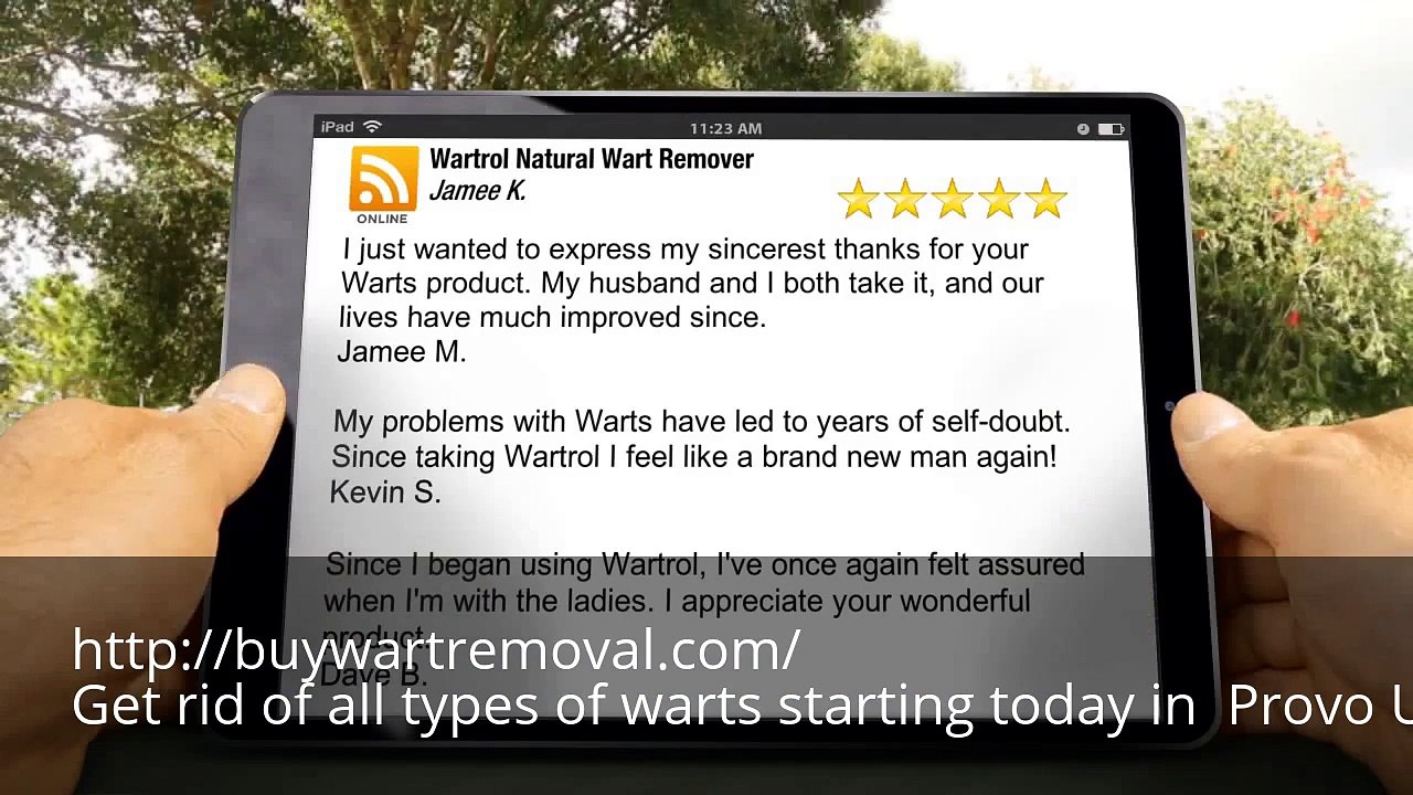 Where Can I Buy Wart Remover in Provo UT