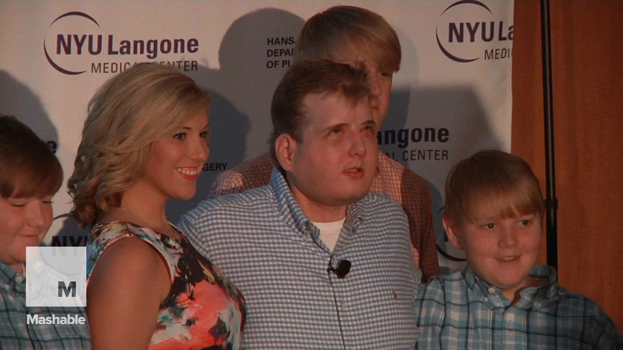 World's most extensive face transplant gives firefighter hope