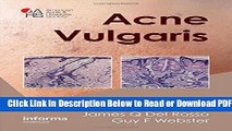 [Download] Acne Vulgaris Free New