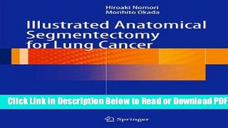 [Download] Illustrated Anatomical Segmentectomy for Lung Cancer Popular New