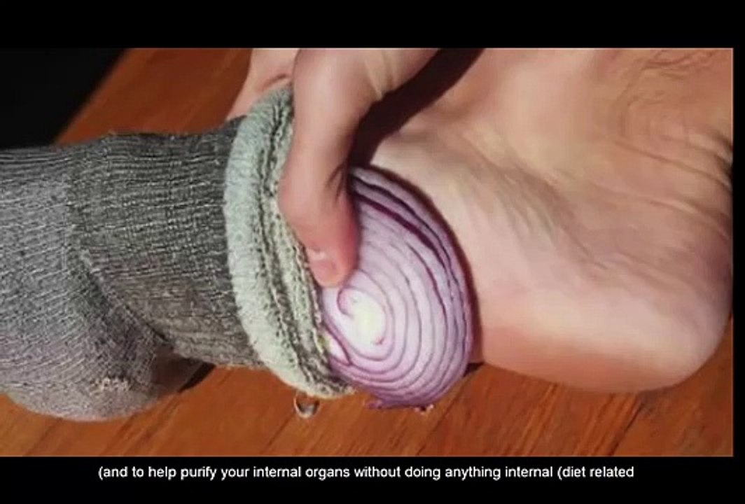 This is What Happens When You Put Cut Up Onions in Your Socks