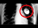 10 Accidental Medical Discoveries