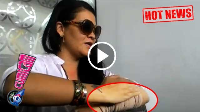 Hadiri Sidang Cerai, Tangan Melanie Subono Diperban - Cumicam 29 Agustus 2016