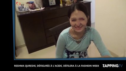 New-York : Défigurée à l'acide, une jeune indienne défilera pour la Fashion Week