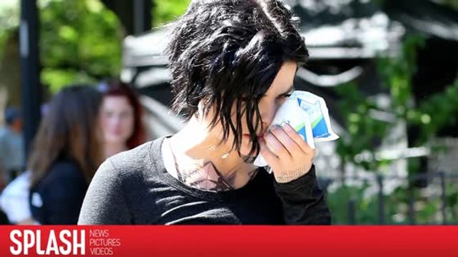 Jaimie Alexander Isn't the First Injured Celebrity