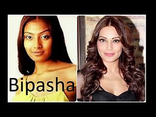 Do you know these celebrities went for whitening treatment to become fair and lo