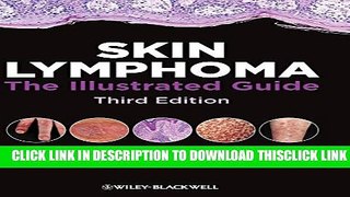 [Read] Skin Lymphoma: The Illustrated Guide Popular Online